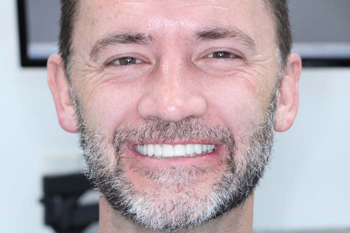 The image shows a man with a beard smiling at the camera.