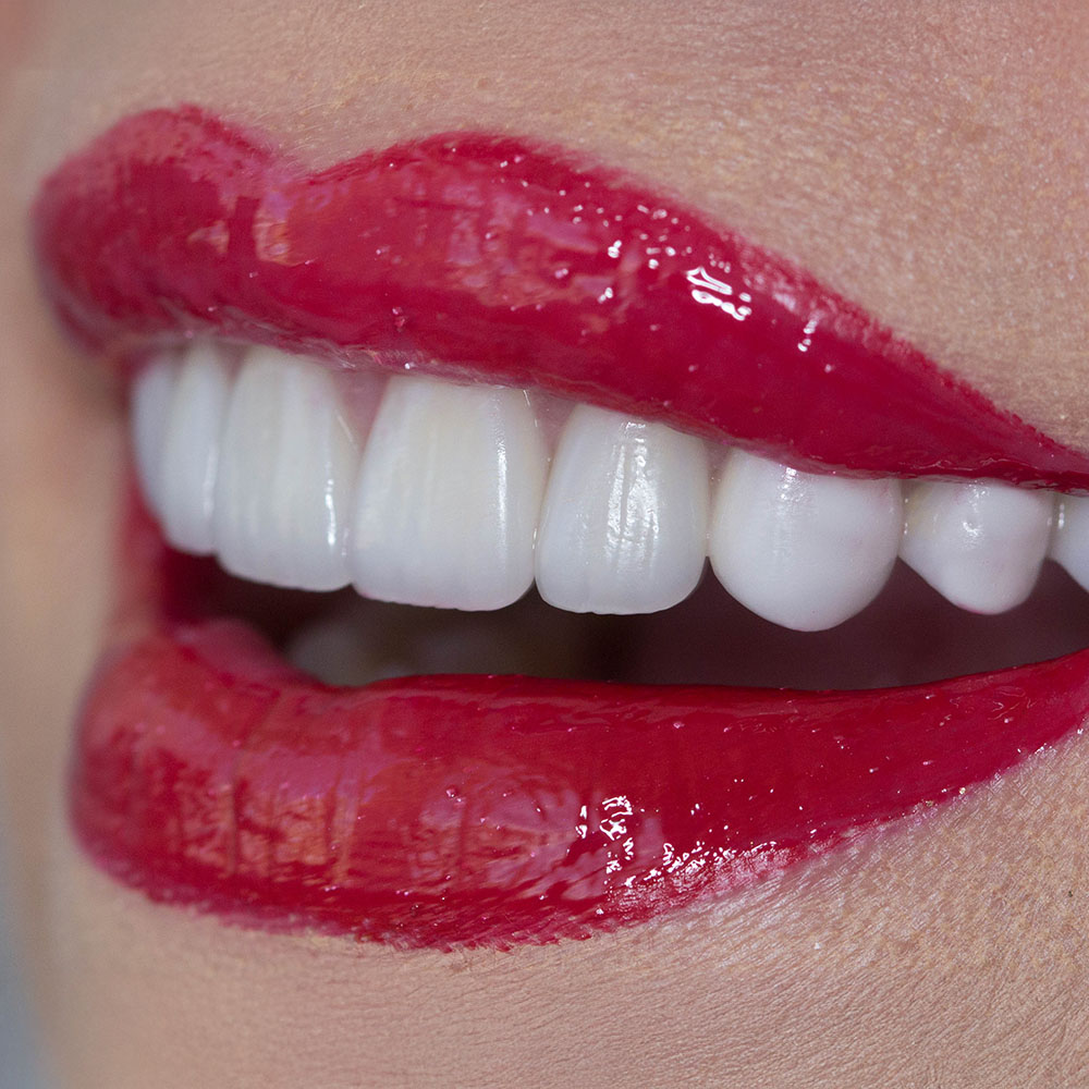 The image shows a close-up view of a person s lips painted red with white teeth, against a neutral background.